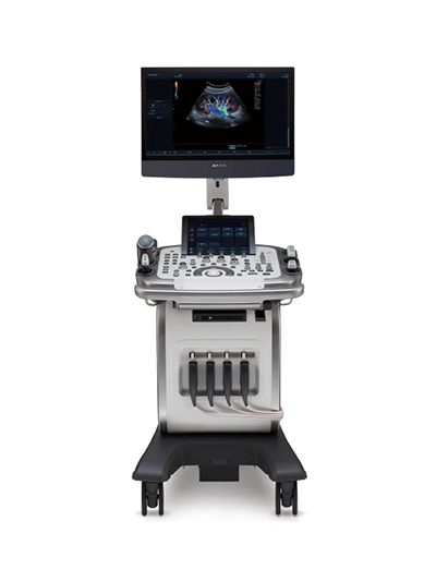 초음파 검사장비